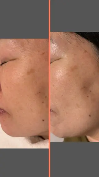 大阪大東市 / 体質・肌質改善サロン アンシャンテ所属・体質・肌質改善サロン アンシャンテのエステ・リラクイメージ