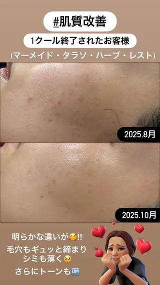 LiZA エステティックサロンのエステ・リラクイメージ