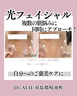 Dr.ALII岐南店所属・Dr.ALII 岐南店　鈴村のマツエク・マツパデザイン