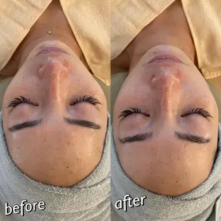 うなじ脱毛/美肌脱毛 LABELのエステ・リラクイメージ