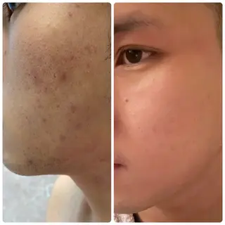 skin make salon -Olu's-所属・毛穴・肌質改善サロン ✨Tomaのその他イメージ