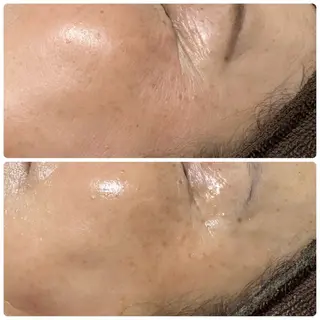 肌育脱毛サロン LikoLinaのその他イメージ