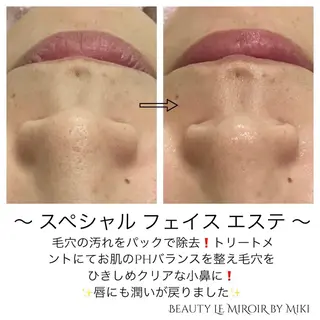 ビューティー ミロワールのエステ・リラクイメージ