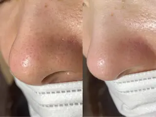 mone~total care salon~所属・mone (モーネ)のエステ・リラクイメージ