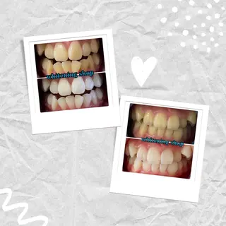 ホワイトニングショップ津店所属・ホワイトニング ショップ津店のその他イメージ