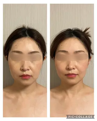 SOLUNA目黒店所属・小顔/毛穴洗浄/痩身 ayako🌿のエステ・リラクイメージ