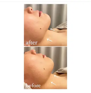 ワックス脱毛🌈 ESPOIRnocoのエステ・リラクイメージ