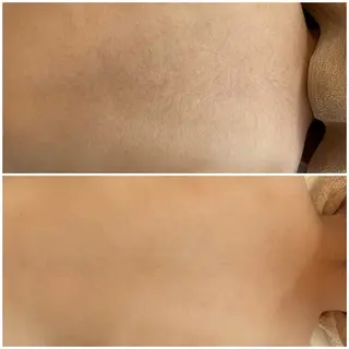 キッズ 脱毛エステサロンViViPirina所属・軽部 歩のエステ・リラクイメージ