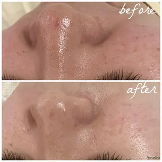 メンズ メナード岐阜市茜部 杉浦のエステ・リラクイメージ