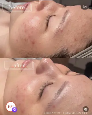 YUIITSU所属・YUIITSU 小顔コルギのエステ・リラクイメージ