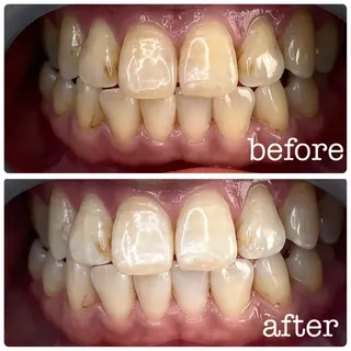 DH. MISATOの眉毛・アイブロウイメージ