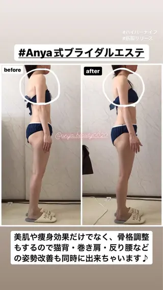 Anya Beautyのエステ・リラクイメージ