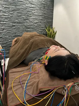 美容鍼灸整体サロンBeauJu所属・小顔矯/美容鍼/鍼灸 BeauJuのその他イメージ