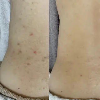 シェノン所属・ニキビ・毛穴・ フェイシャル専門店のその他イメージ