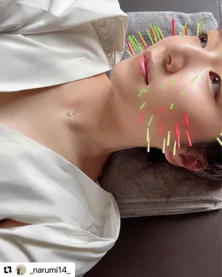 鍼灸整骨院Refine所属・鍼灸 Refineのその他イメージ