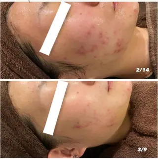 本気の肌質改善スキン デトックス🌿のエステ・リラクイメージ