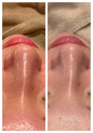 ANERA Second所属・尾上 沙織のエステ・リラクイメージ