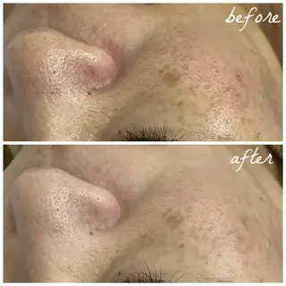 メンズ メナード岐阜市茜部 杉浦のエステ・リラクイメージ