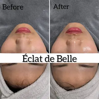 Éclat de Belle🫧白玉肌のその他イメージ