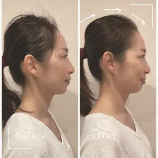 小顔×肌質改善サロン soin〔ソワン〕のエステ・リラクイメージ