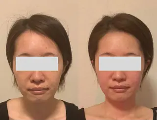 a room salonのエステ・リラクイメージ