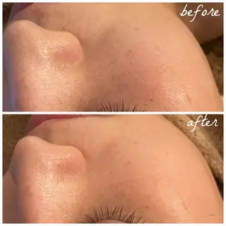 メンズ メナード岐阜市茜部 杉浦のエステ・リラクイメージ