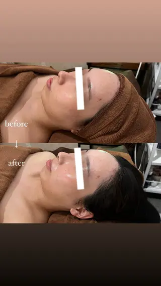 NOEL所属・フェイシャルエステ Utaiのエステ・リラクイメージ