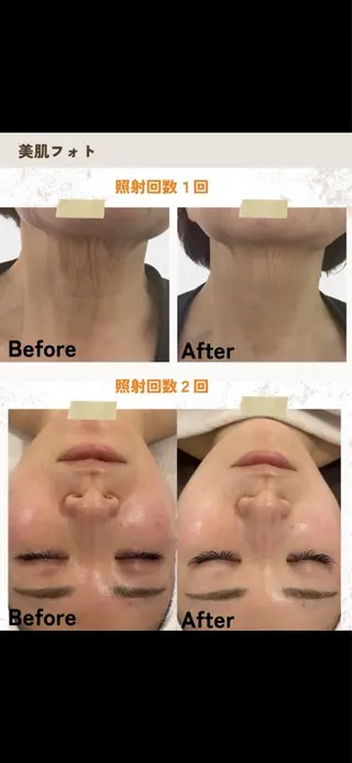 美ボディメイクサロン　only one body所属・所沢 痩身エステサロンのエステ・リラクイメージ