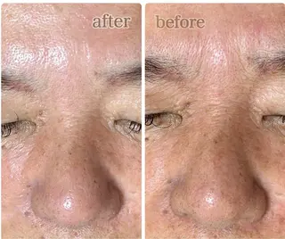 private salon 𝐋𝐈𝐍𝐃𝐄𝐙𝐀所属・LINDEZA Ayaのエステ・リラクイメージ