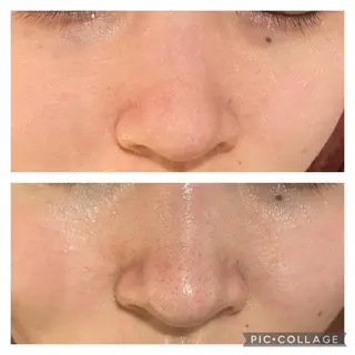 ショート カラー パーマ ヘアアレンジ メンズ キッズ ネイル マツエク・マツパ アイブロウ ニキビ特化型エステ 🍓最短で肌質改善のエステ・リラクイメージ