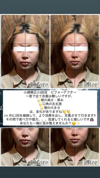 💎後悔させない小顔 矯正💎イトヤマ🌱のエステ・リラクイメージ