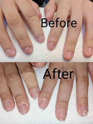 ネイル ネイリストゆか💅 長さだし、深爪矯正のネイルデザイン