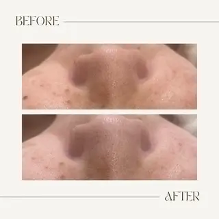 CEsalonEgg 齋藤のエステ・リラクイメージ