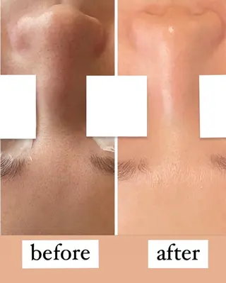 Lien~毛穴 専門サロンのその他イメージ