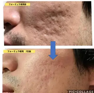 🏳️🌈 CHIYAKAのエステ・リラクイメージ