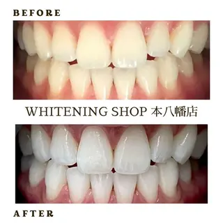 メンズ ホワイトニング ショップ本八幡店のエステ・リラクイメージ