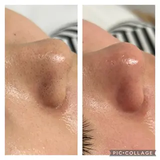 BeautySalonGemmy所属・Gemmy 愛美のエステ・リラクイメージ