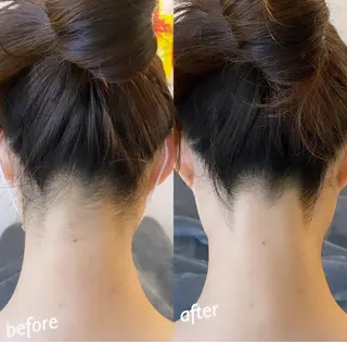 うなじ脱毛/美肌脱毛 LABELのエステ・リラクイメージ