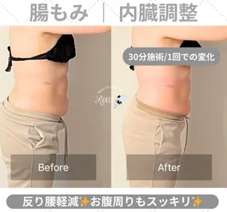 【頭痛、睡眠改善】 salon RUUのエステ・リラクイメージ