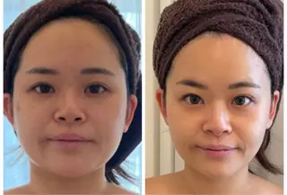 小顔コルギ＆オイル アンドエスのエステ・リラクイメージ