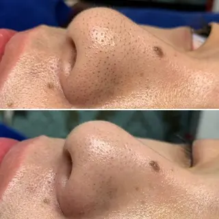 aroma  YURARI所属・韓国艶美人// 毛穴ケア🌹のエステ・リラクイメージ