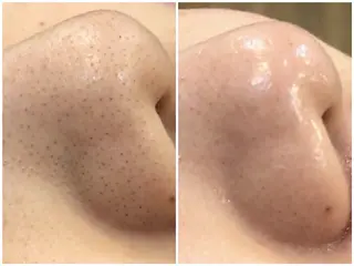 渋谷小顔矯正 毛穴洗浄ウミのエステ・リラクイメージ