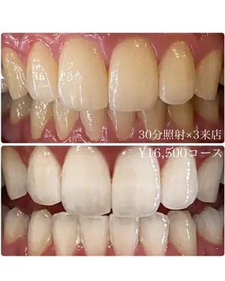 メンズ ホワイトニングルーム　川崎店所属・ホワイトニング ルーム　川崎店のその他イメージ