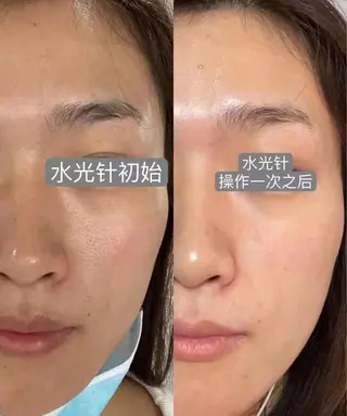 aliaハイフ&水光ジェットサロン所属・aliaハーブ水光店 エステティシャン募集のエステ・リラクイメージ