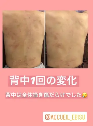 ミディアム カラー パーマ ヘアアレンジ メンズ キッズ ネイル マツエク・マツパ ニキビ・肌質改善専門 ♡人生が変わるサロンのエステ・リラクイメージ