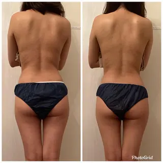 食べながら魅せボディ éclatJua川越のエステ・リラクイメージ