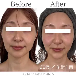 esthetic salon PLANTS所属・エステティックサロン PLANTSのエステ・リラクイメージ