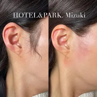 HOTEL&PARK . ワックス脱毛のエステ・リラクイメージ