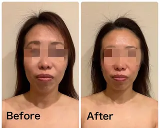 美肌脱毛サロン muroのエステ・リラクイメージ