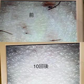 Thu Huyen Beauty所属・トウ フェンのエステ・リラクイメージ